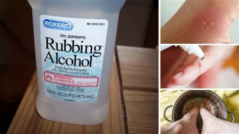The pus in your boil will begin to drain by itself, and your boil will heal within a few weeks. . Does rubbing alcohol kill chlamydia on surfaces